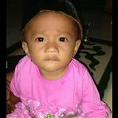 Kết
